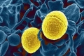 بكتيريا آكلة للحوم البشر وتنتقل بالعدوى تنتشر في بريطانيا