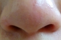 أنف الإنسان قادر على تمييز تريليون رائحة
