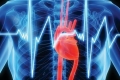الكالسيوم مؤشر على النوبات القلبية