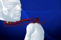 مشروع جراح إيطالي لزرع رأس بشرية يثير شكوك الوسط الطبي