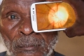 تطبيق للهواتف الذكية قادر على تشخيص أمراض العين‎
