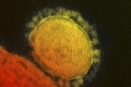 لماذا نخاف من فيروس كورونا الجديد أكثر من خوفنا من الإنفلونزا؟