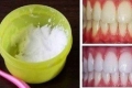 وصفة طبيعية مذهلة لتبييض الأسنان فى دقيقة واحدة