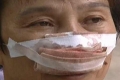 بالفيديو: لم ترد زوجته على اتصالاته.. فقضم أنفها وابتلعها!