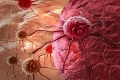 علماء يكتشفون سبب مقاومة الأورام السرطانية للأدوية