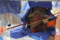 عازف كمان يعزف أثناء خضوعه لعملية جراحية