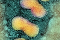 وفاة شخصين في الصين بسلالة فيروس انفلونزا الطيور لم يسبق انتقالها إلى البشر