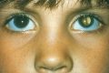 ما هو سر النقاط السابحة التي تظهر أمام العين؟