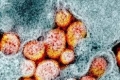 مفاجأة: البشرية شهدت وباء لفيروسات كورونا قبل 20 ألف عام