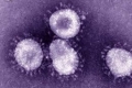 ماهو فيروس كورونا؟ أعراضه؟ وهل من علاج للمريض؟