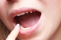 جروح الفم أسرع في الشفاء من جروح باقي الجسم، وهذا هو السبب!