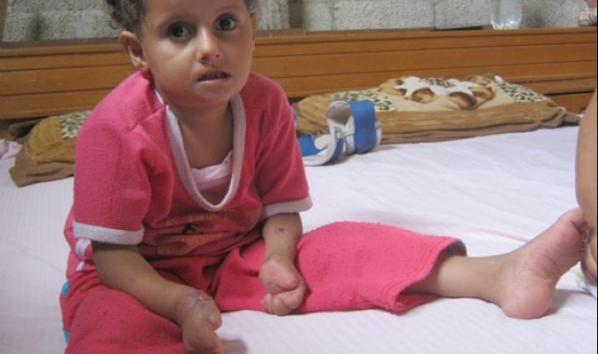 في حادثة غريبة .. بالصور والفيديو:- طفلة فلسطينية تأكل أصابعها العشرة