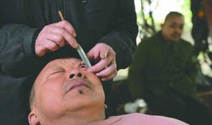 لا تخف أبداً وحتى ترى جيداً!!... بالصور المرعبة: فن تنظيف مقلة العين عند الحلاق في الصين