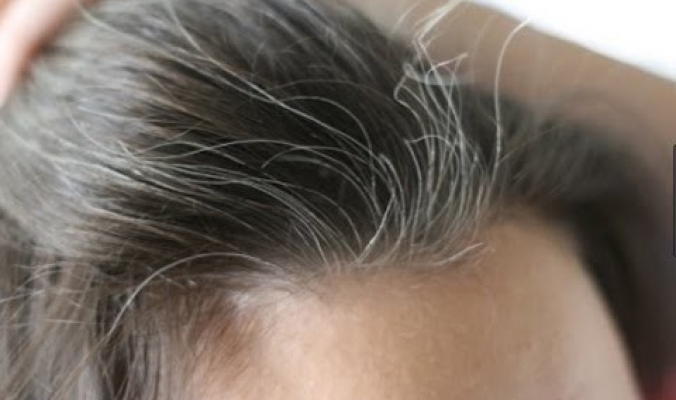 هل يؤدي اقتلاع الشعر الرمادي (الأبيض) إلى نمو المزيد منه؟