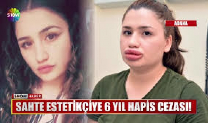 بالفيديو... شاهد ما حدث لفتاة تركية أرادت نفخ شفتيها