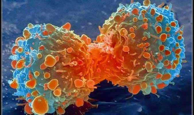 تطور لافت في محاربة مرض السرطان