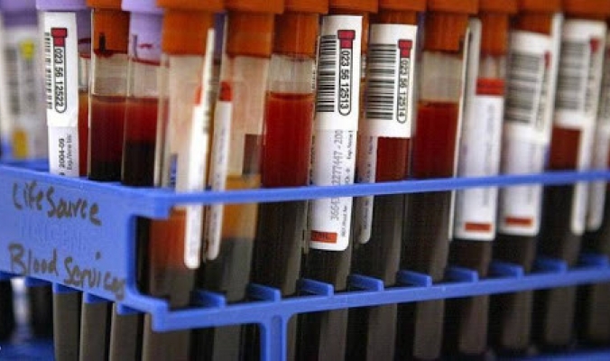 لماذا عليك معرفة فصيلة الدم الخاصة بك؟