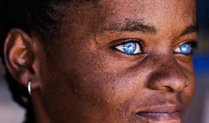 ليس فقط بسبب الوراثة.. لماذا يمتلك بعض الأفارقة أعينًا زرقاء؟؟