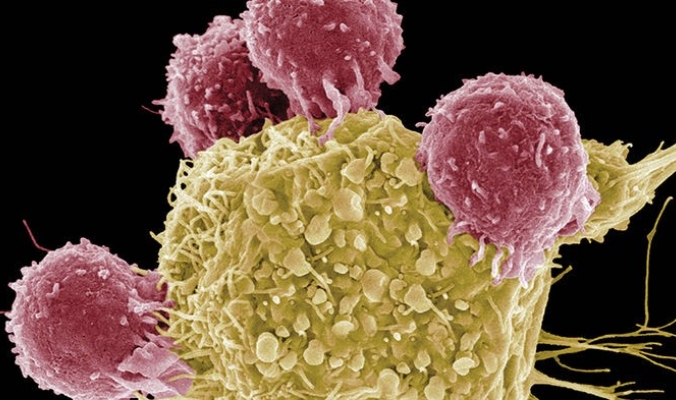 أبحاث سريرية تبعث الأمل بنجاح تطوير لقاح للسرطان