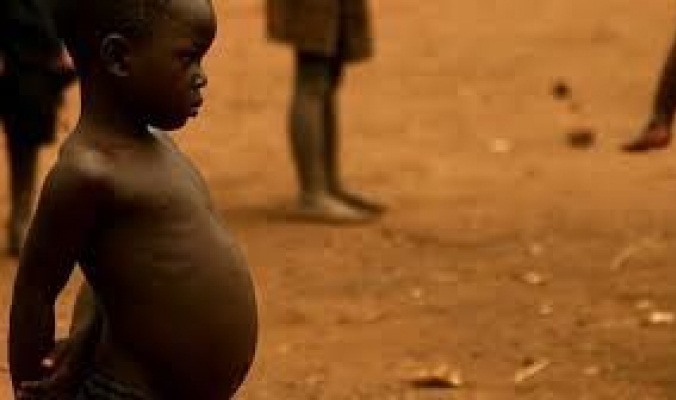 لماذا ينتفخ بطن الأطفال الذين يعانون من سوء التغذية؟