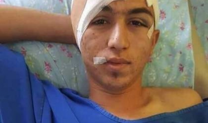 وفاة الشاب محمد جرار بحادث سي بسيط... والعائلة تتهم الأطباء