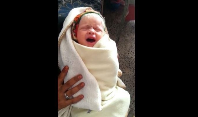 بالفيديو | رضيعة يمنية ولدت بـ&quot;شعر أبيض&quot;!!