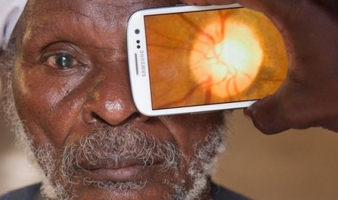 تطبيق للهواتف الذكية قادر على تشخيص أمراض العين‎