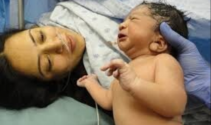 نتائج خطيرة للولادة بدون ألم.. العمليات القيصرية تجتاح دول العالم