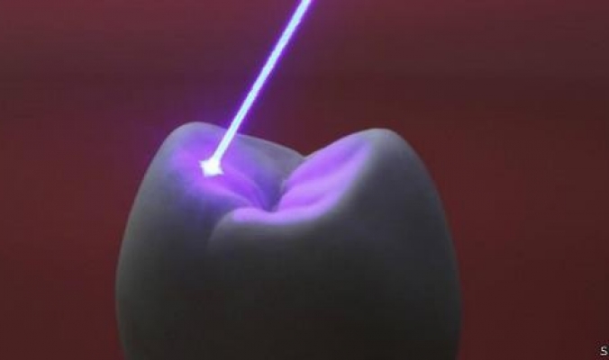 تقنية الليزر لإعادة نمو الأسنان