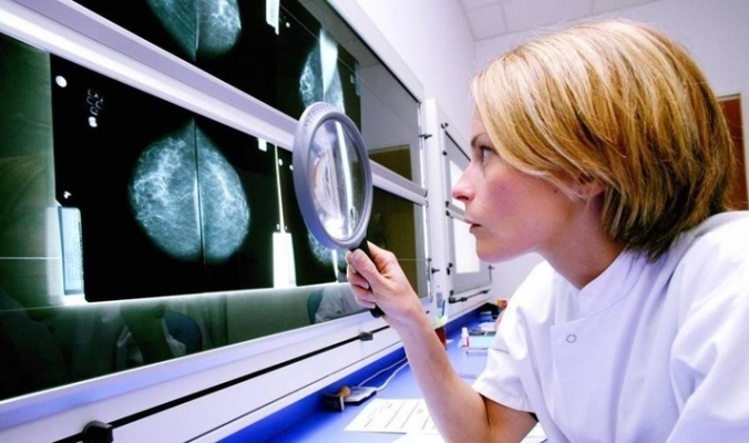 اكتشاف عامل خطورة جديد مرتبط بالإصابة بسرطان الثدي