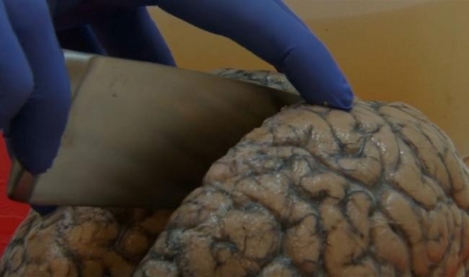 3000 دماغ بشري تحت تصرف أطباء مختصين في بلجيكا