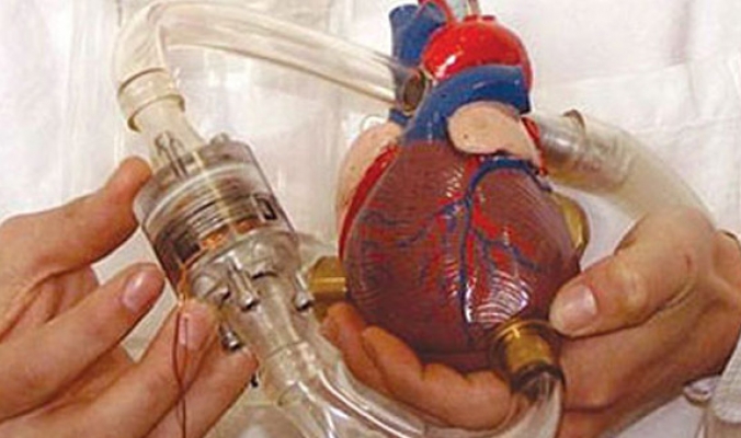 قلب صناعى يعمل ببطارية لإطالة حياة مرضى القلب